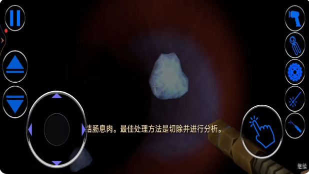 肠胃医院(这是大肠的复仇)